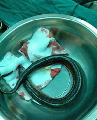 operation sanctuary hentai gen original eel removed from man stuck colon photo